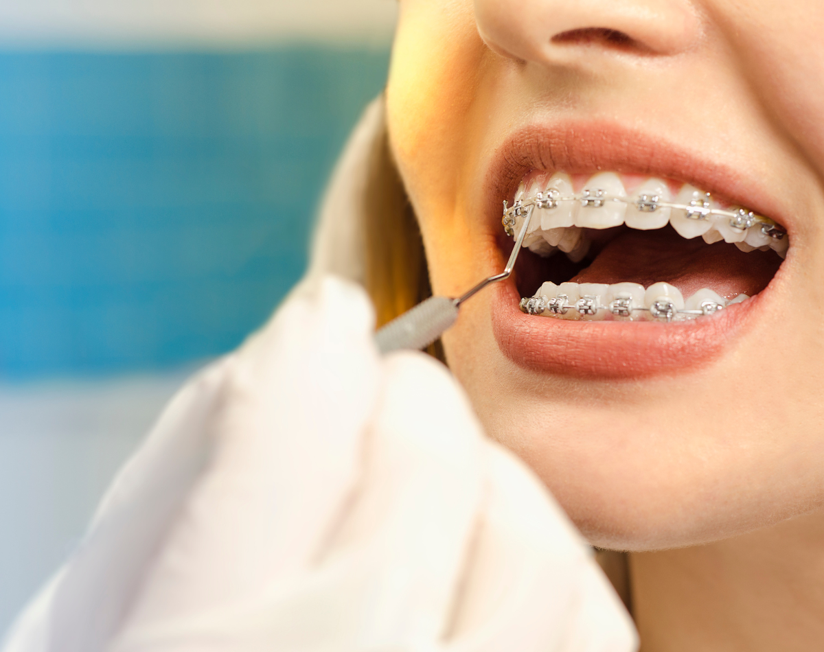 https://stardentalyyc.ca/wp-content/uploads/2025/03/Star-Dental-Calgary-NE-Dentist-working-3.png